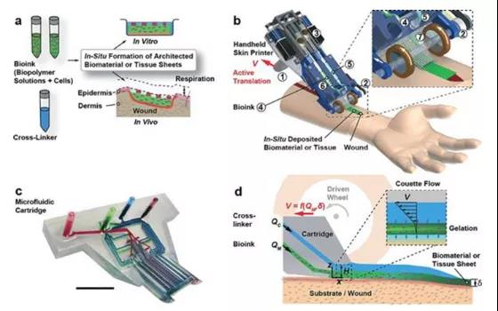 利用3D打印技術(shù)修復(fù)深度傷口只需要2分鐘