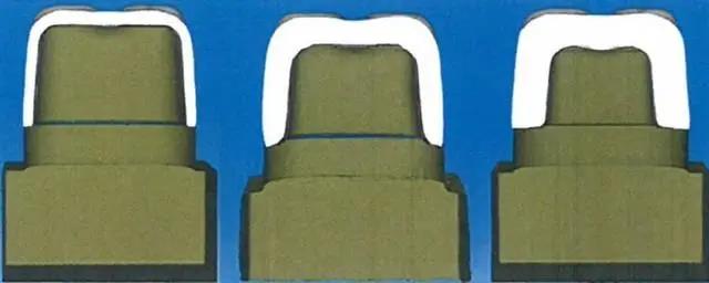 SAREMCO齒科發(fā)布3D打印齲齒填充樹脂