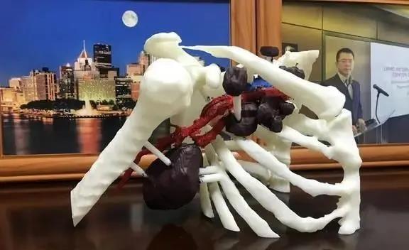 “3D打印”來助陣 中西醫治療讓乳癌患者獲新生