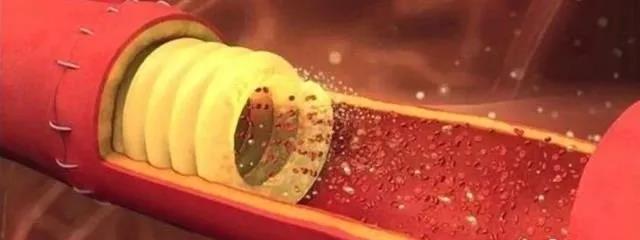 澳科研機構研發出一種3D打印血管支架