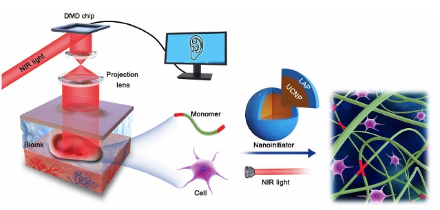四川大學華西醫院：無創體內生物3D打印