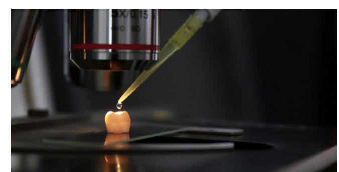 壞掉的牙齒有救啦！浙大科研團隊用3D打印幫你修復大白牙