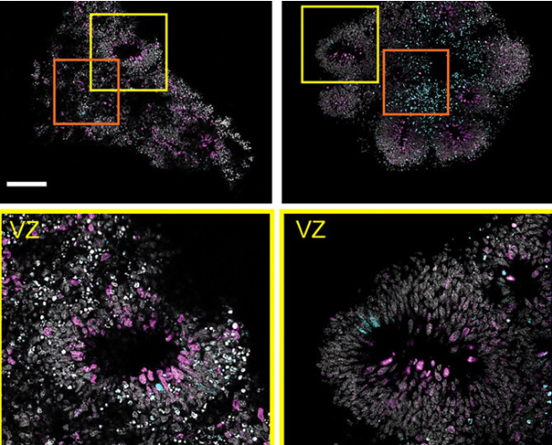 科學家使用廉價的3D打印生物反應器培育人類新皮質