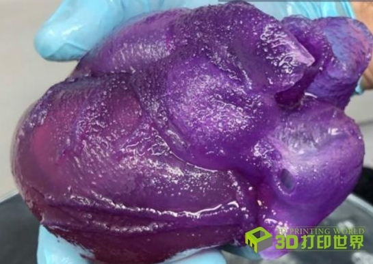 首個3D打印全尺寸人體心臟模型震撼來襲