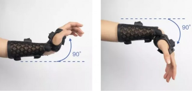 康復輔具賽道，3D打印逐漸深入應用