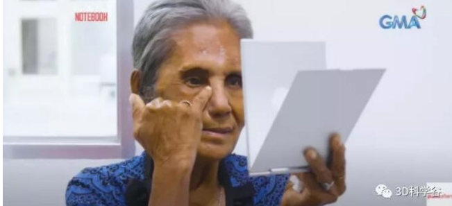 3D數字化技術為面部修復帶來快速、精準解決方案