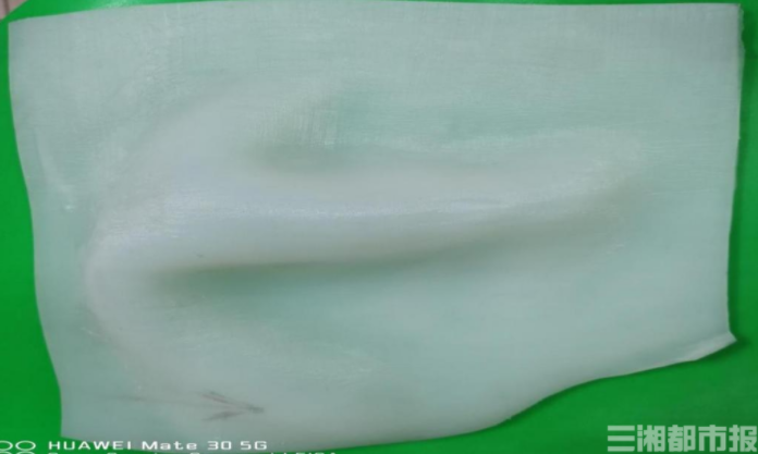 放療前用3D打印仿真組織代替人體組織，湖南醫生做到了