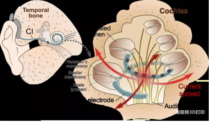 劍橋大學(xué)《自然》子刊：凝聚3D打印和人工智能在模擬耳蝸的應(yīng)用