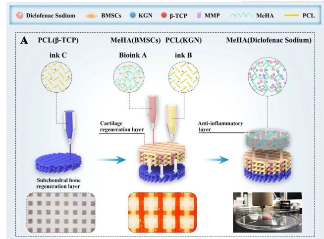 生物3D打印仿生支架促炎癥環境下骨軟骨缺損有效再生