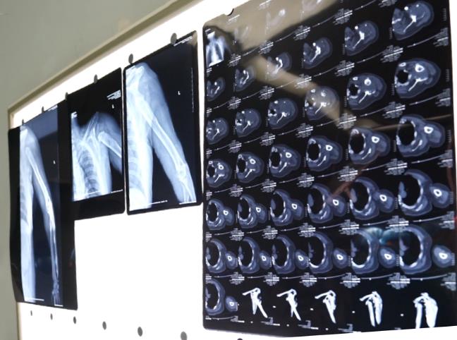 青島3D打印，山東3D打印，北方3D打印，光固化，樹脂，3D打印