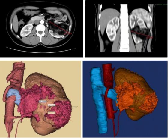 青島3D打印， 山東3D打印，北方3D打印，光固化，樹脂，3D打印
